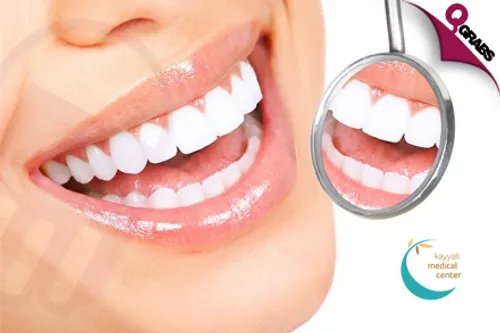 From QR1500 Improve the Appearance of Your Teeth with Veneers! (Up to QR12000 Value)